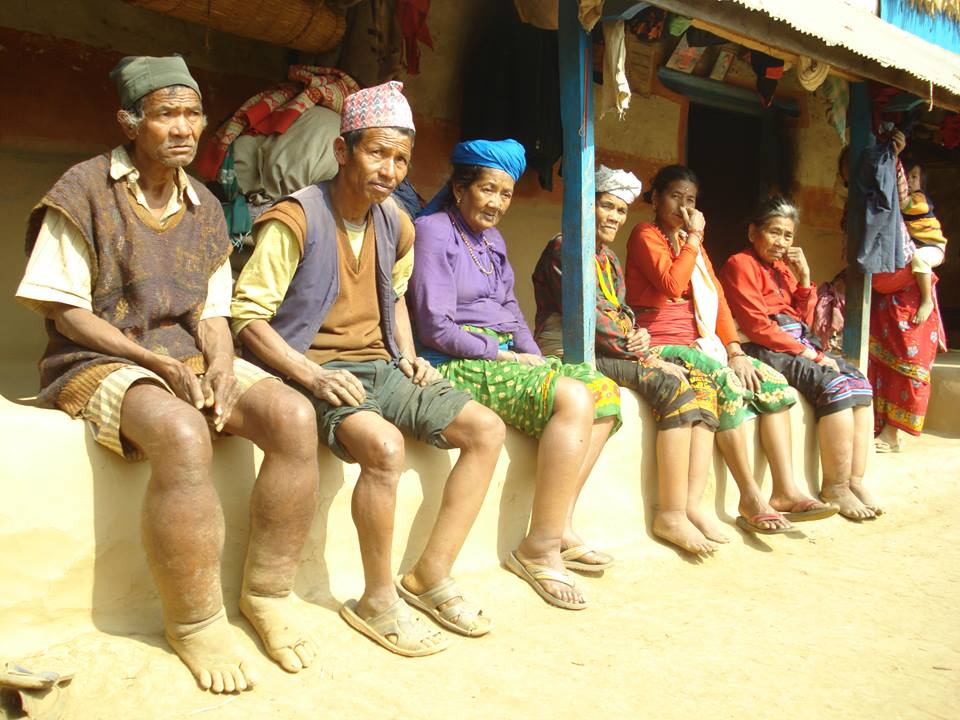 लमजुङमा फागुन ११ गतेदेखि १४औं पटक हात्तीपाइले विरुद्धको औषधी खुवाइने